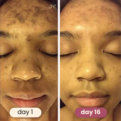 🏆#1 Best Selling🏆 Turmeric Kojic Acid Cleansing Pads